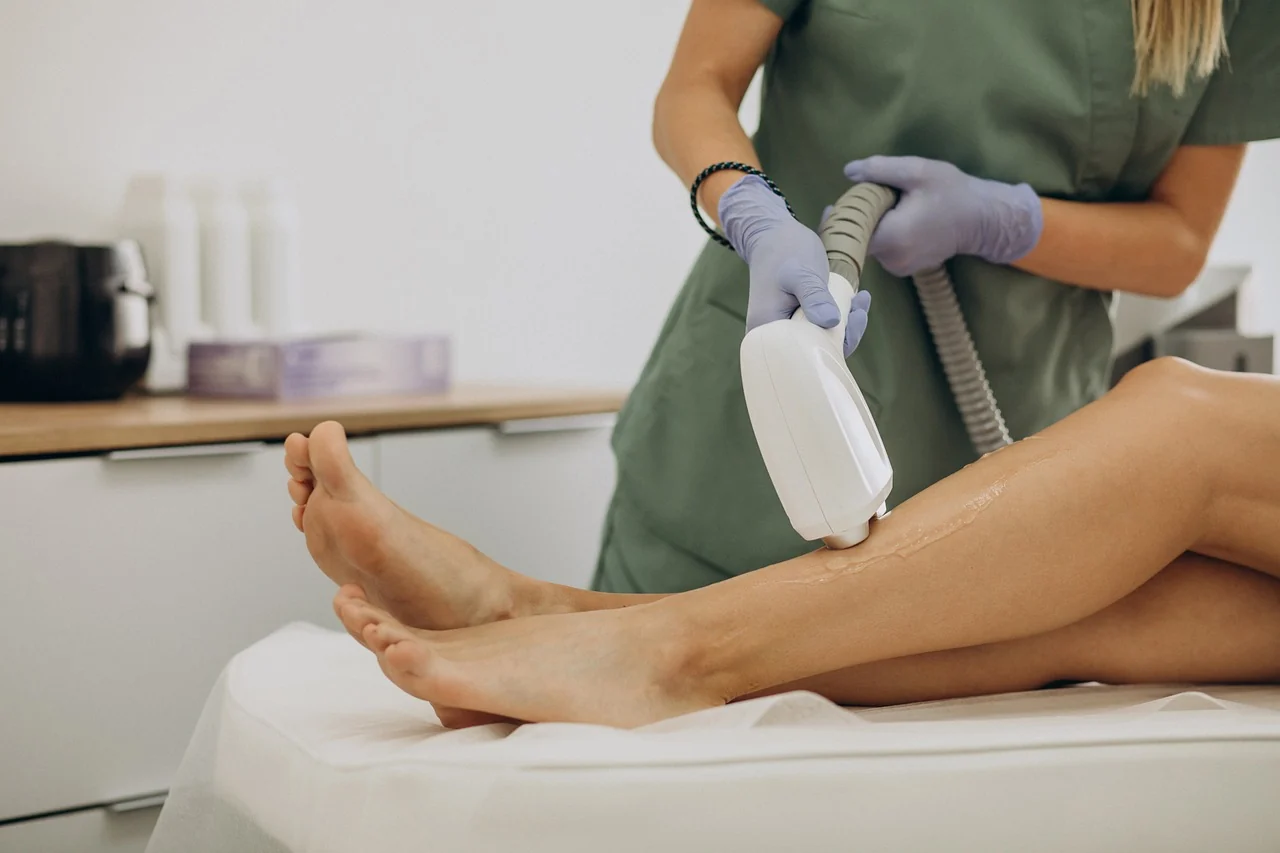 How Effective Is Vein Removal Treatment NY?