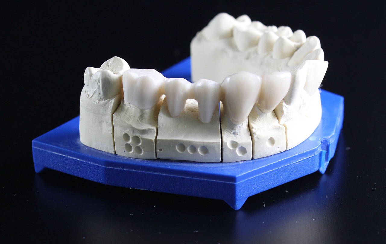 Is Aspen Dental a Rip Off After Payment? Why the Phrase Appears Post-Commitment