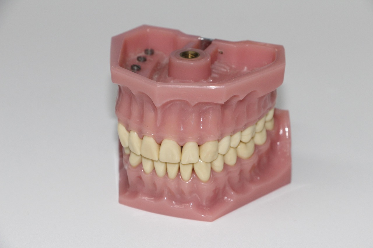 Benefits Of Choosing Dental Implants In Pembroke Pines