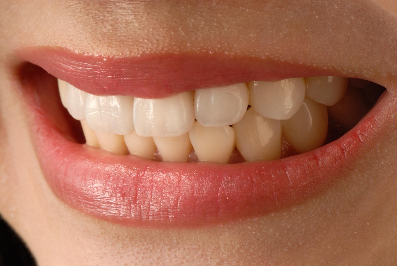 Houston Veneers: Your Ultimate Guide to the Perfect Smile