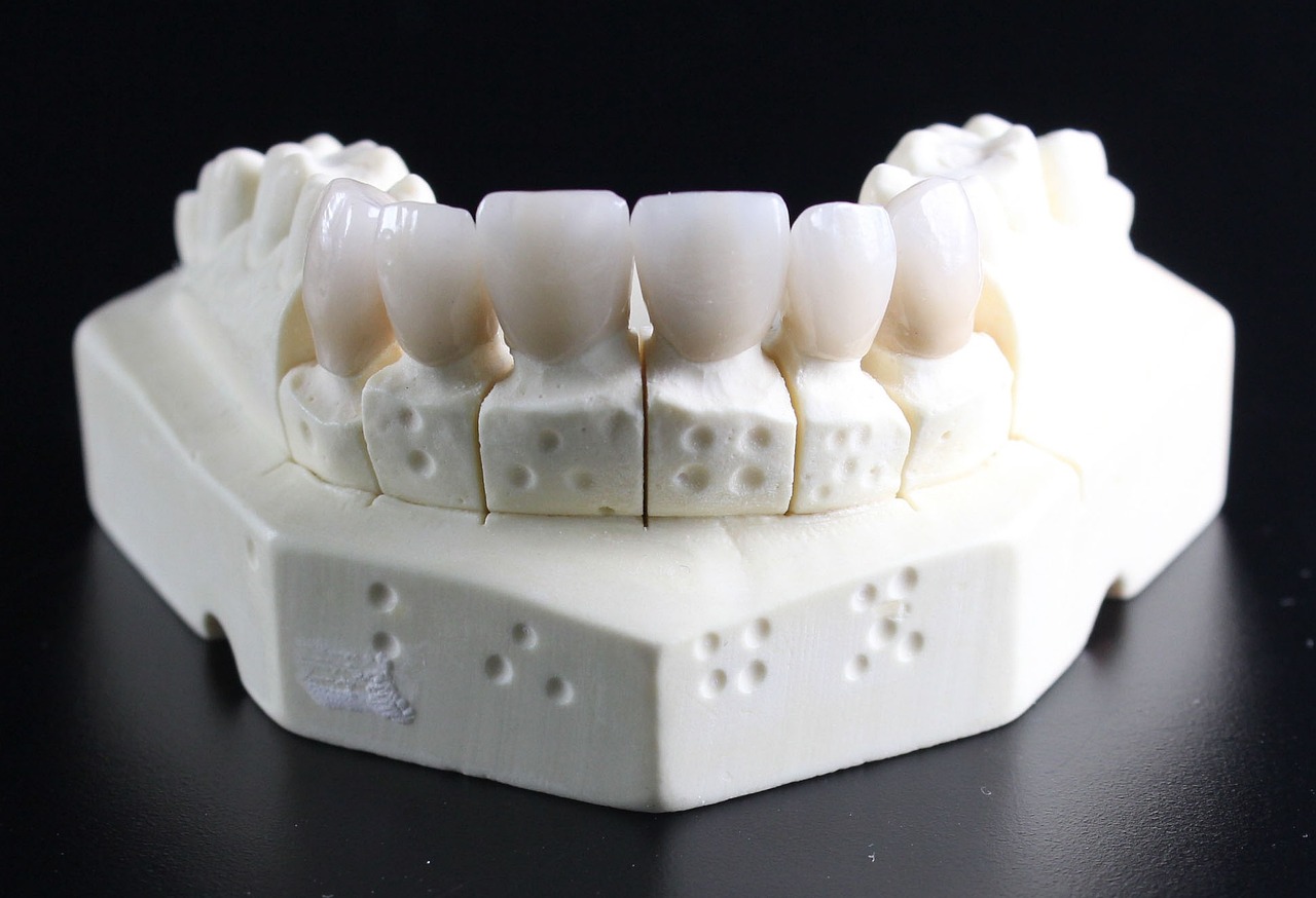 How To Find The Best Dental Implants Specialist Near You?