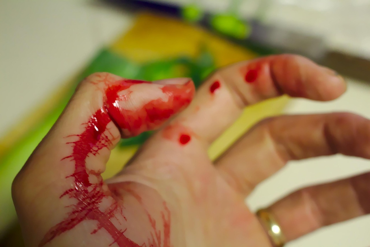 When a Motorcyclist Gets Hurt in a Car Accident, Who Are the Victims?