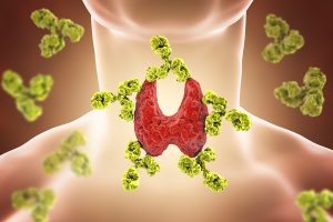 Autoimmune Thyroiditis