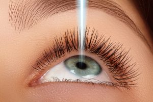 LASIK eye doctor