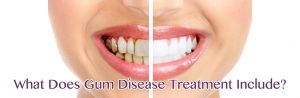 Gum Disease Treatment