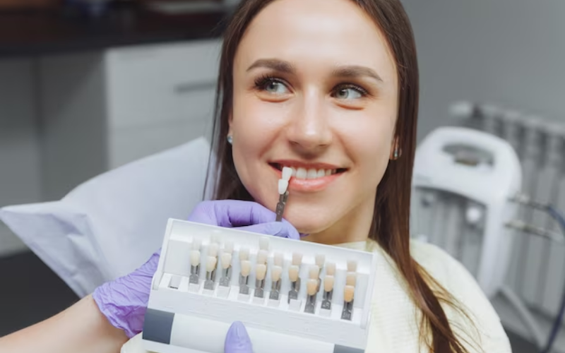 dental veneers in tucson
