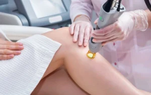 brazilian laser hair removal