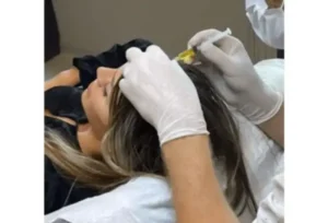 Mesotherapy In Istanbul