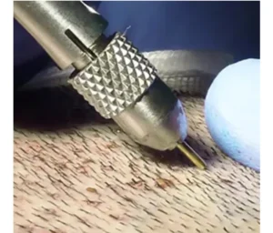 Hair Transplant in Turkey