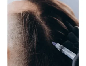 Mesotherapy in istanbul